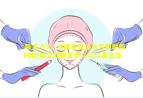 韩式 🌴 双眼皮成功与否何时能判断(韩式双眼皮多久可以看出是否失败)